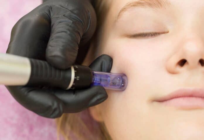 Microneedling what is Mission